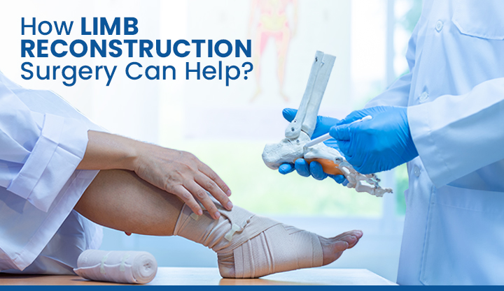 How Limb Reconstruction Surgery Can Help