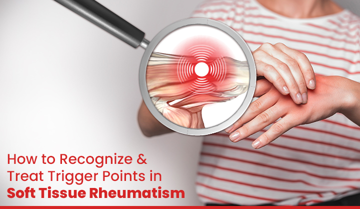 How to Recognize and Treat Trigger Points in Soft Tissue Rheumatism