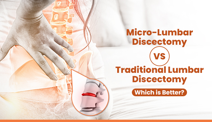 Micro-Lumbar Discectomy vs. Traditional Lumbar Discectomy Which is Better