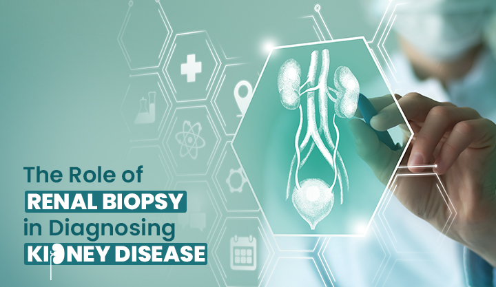 The Role of Renal Biopsy in Diagnosing Kidney Disease