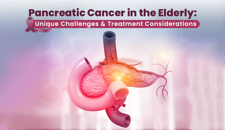 Pancreatic Cancer in the Elderly Unique Challenges and Treatment Considerations