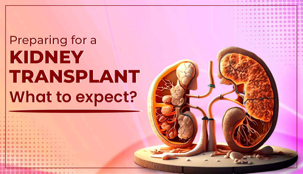 Preparing for a kidney transplant What to expect