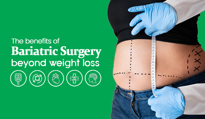 The Benefits of Bariatric Surgery Beyond Weight Loss
