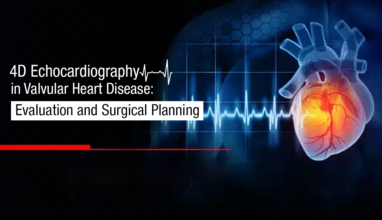4D Echocardiography in Valvular Heart Disease Evaluation and Surgical Planning