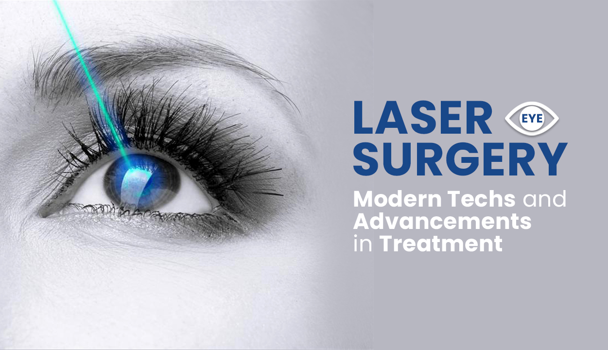 Laser Eye Surgery Modern Techs and Advancements in Treatment