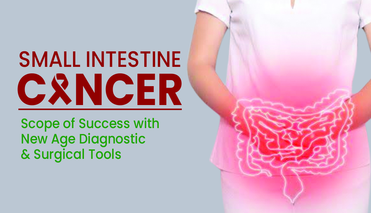 Small Intestine Cancer Scope of success with new age diagnostic & surgical tools