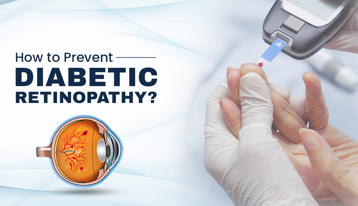 How to Prevent Diabetic Retinopathy