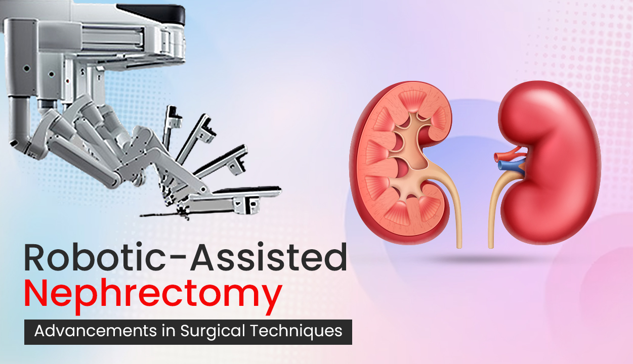 Robotic-Assisted Nephrectomy Advancements in Surgical Techniques