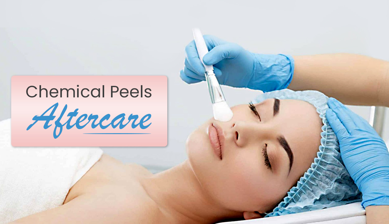 Chemical Peels Aftercare
