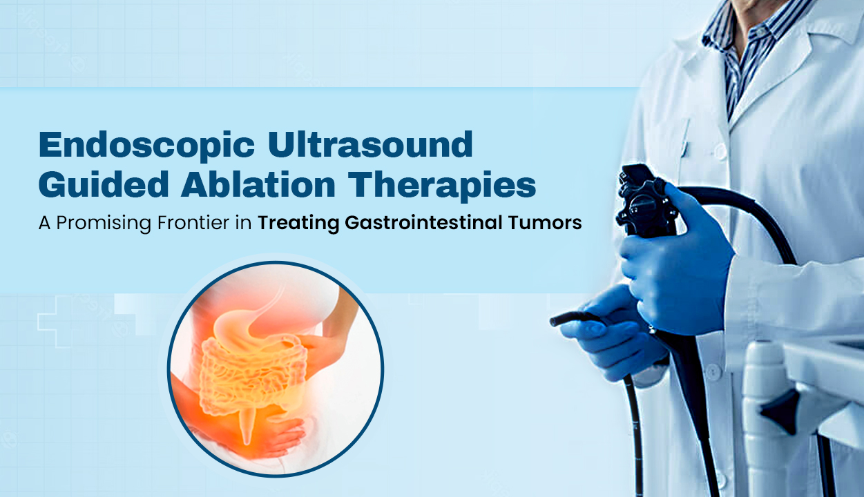 Endoscopic Ultrasound Guided Ablation Therapies A Promising Frontier in Treating Gastrointestinal Tumors