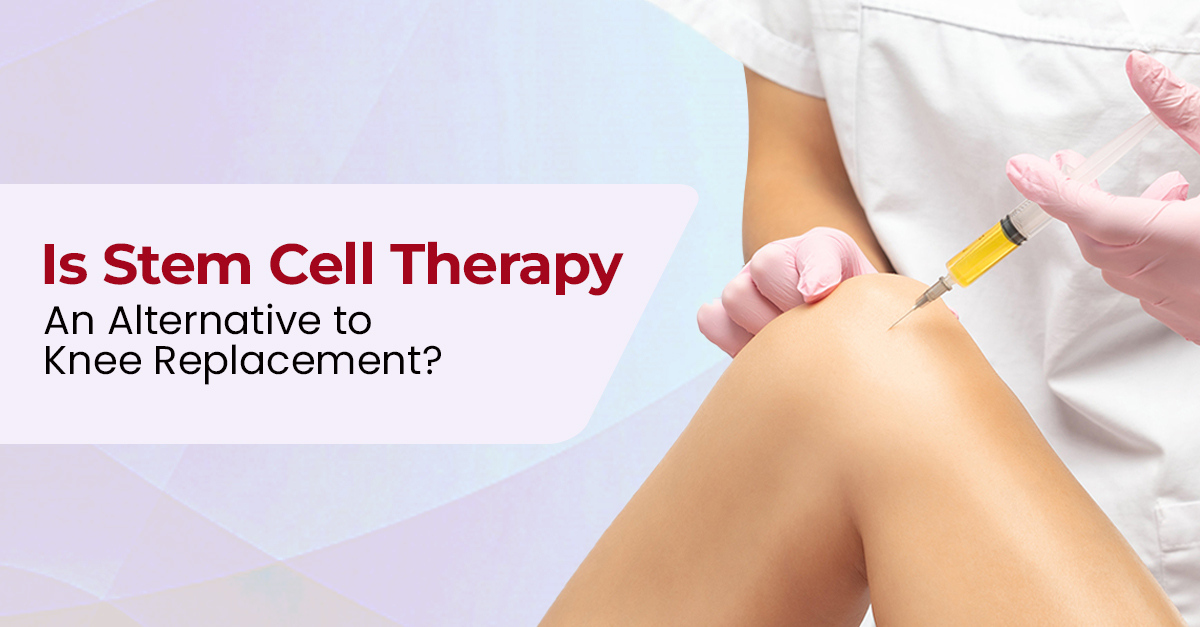 Is stem cell therapy an alternative to knee replacement