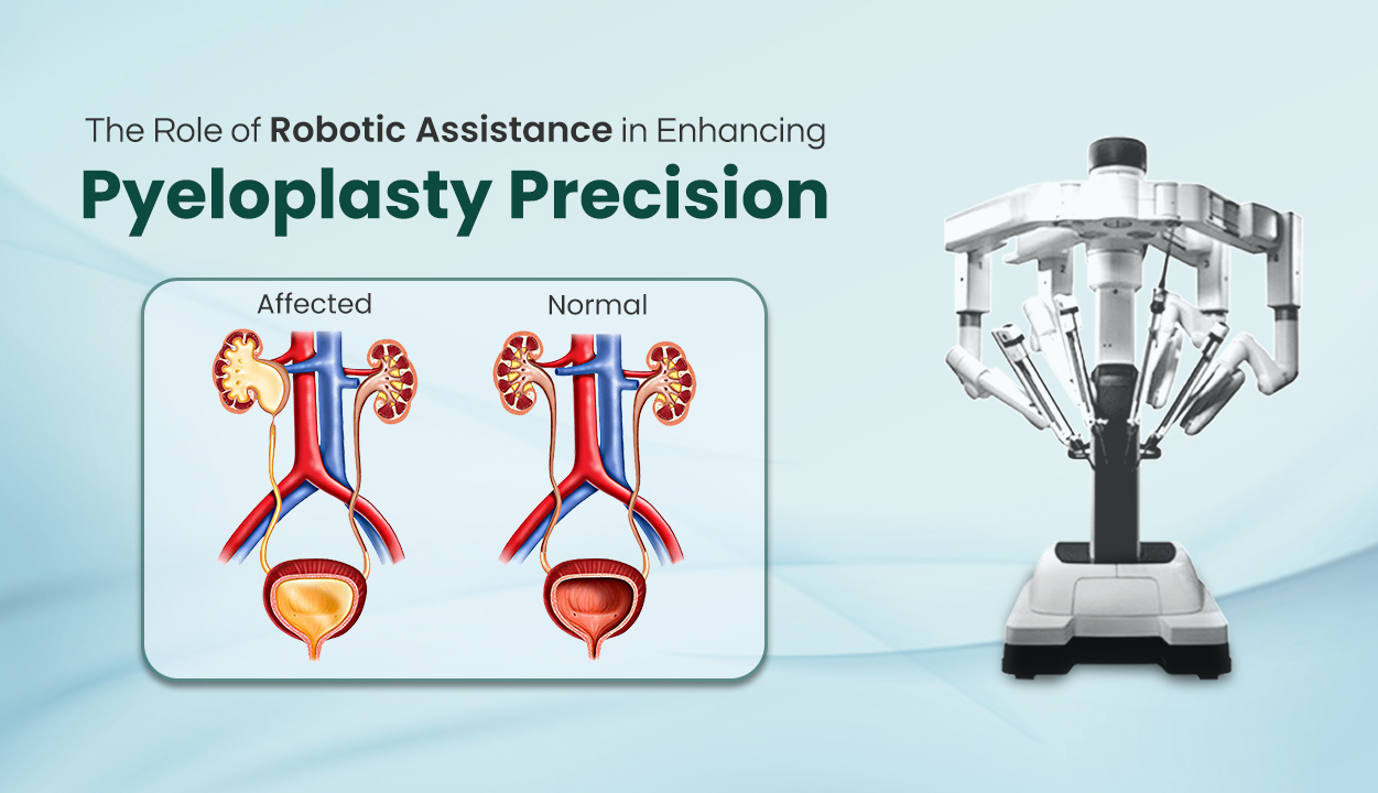 The Role of Robotic Assistance in Enhancing Pyeloplasty Precision