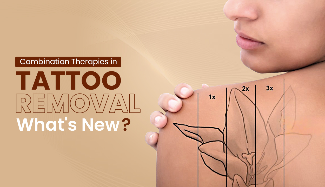 Combination Therapies in Tattoo Removal What's New