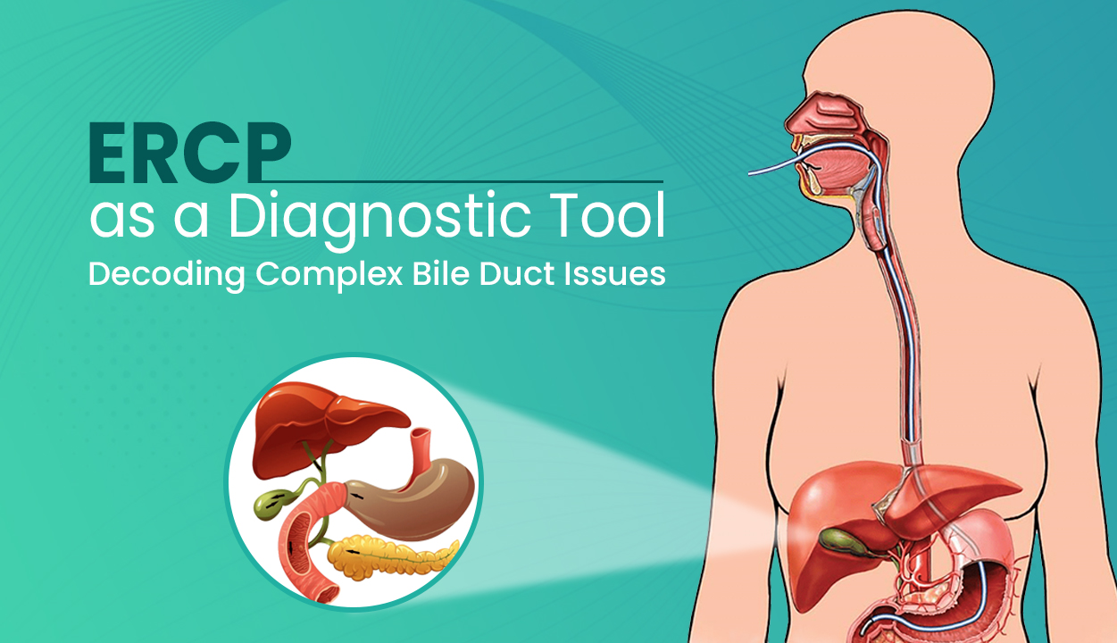 ERCP as a Diagnostic Tool Decoding Complex Bile Duct Issues