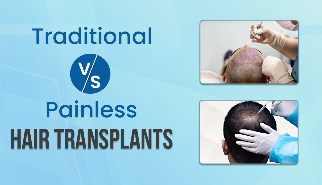 Traditional vs. Painless Hair Transplant