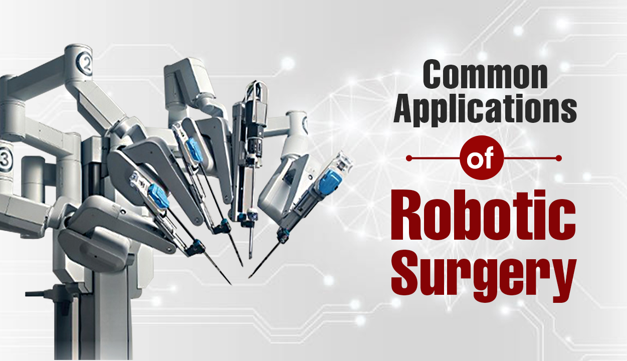 Common Applications of Robotic Surgery