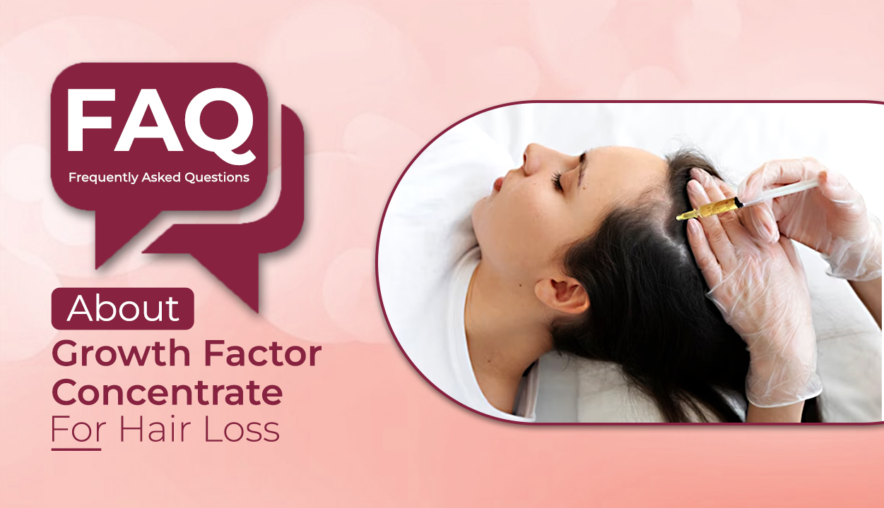 Frequently Asked Questions About Growth Factor Concentrate For Hair Loss