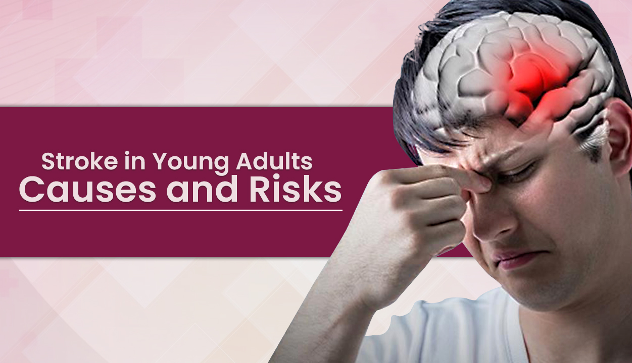 Stroke in Young Adults Causes and Risks