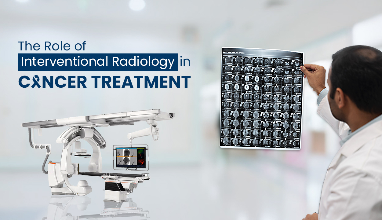 The Role of Interventional Radiology in Cancer Treatment