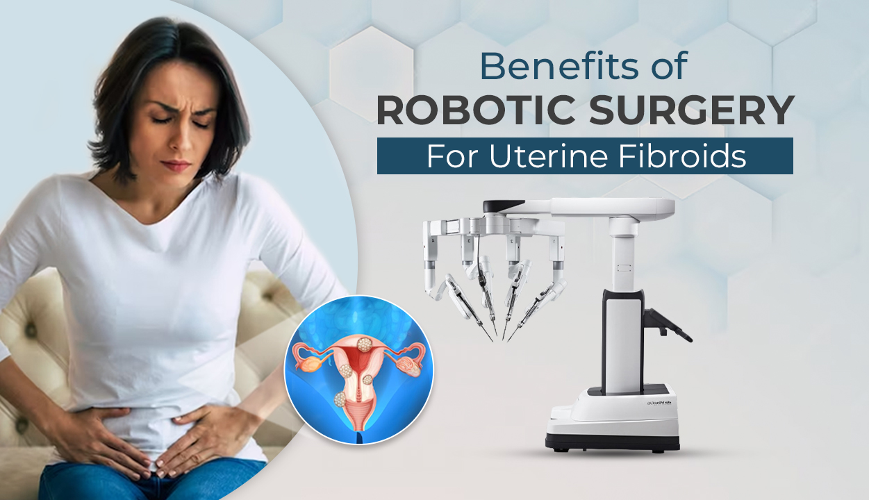 Benefits of Robotic Surgery for Uterine Fibroids