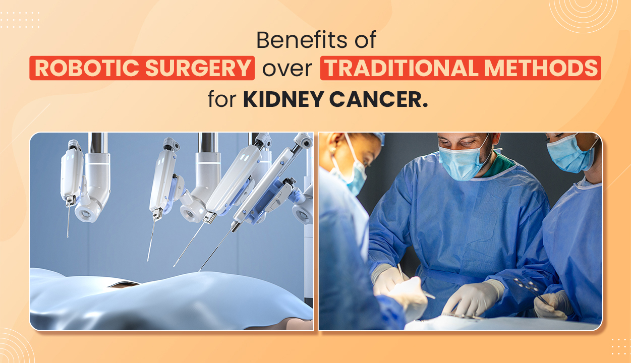 Benefits_of_Robotic_Surgery_for_Kidney_Cancer