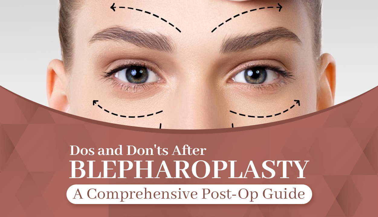 Blepharoplasty