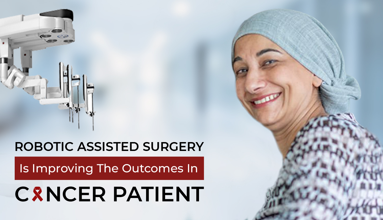 Robotic Assisted Surgery is improving the outcomes in Cancer Patients