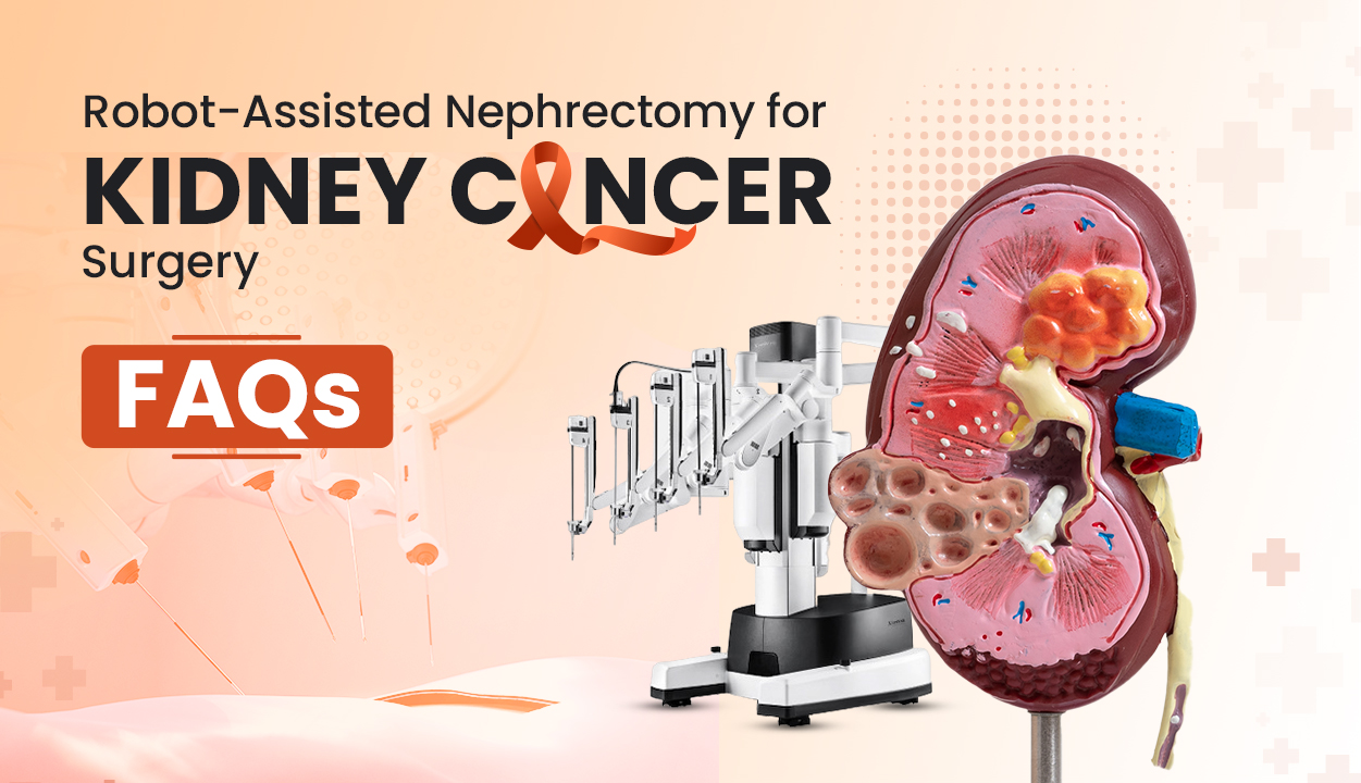 Robotic_nephrectomy_for_kidney_cancer surgery