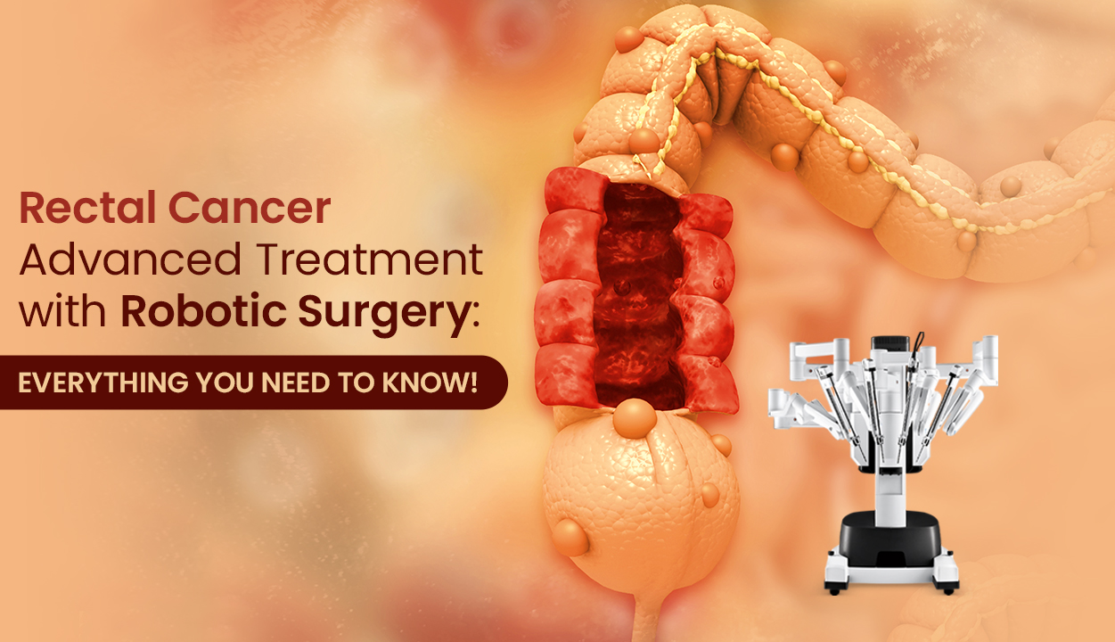 Rectal_Cancer_Robotic_Surgery