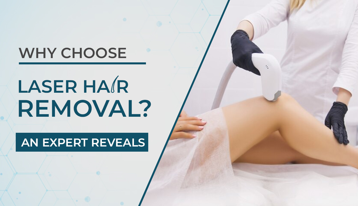 Why Choose Laser Hair Removal An Expert Reveals
