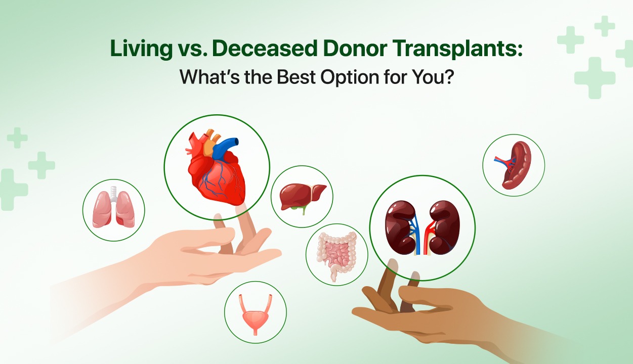 Living vs. Deceased Donor Transplants: What’s the Best Option for You?