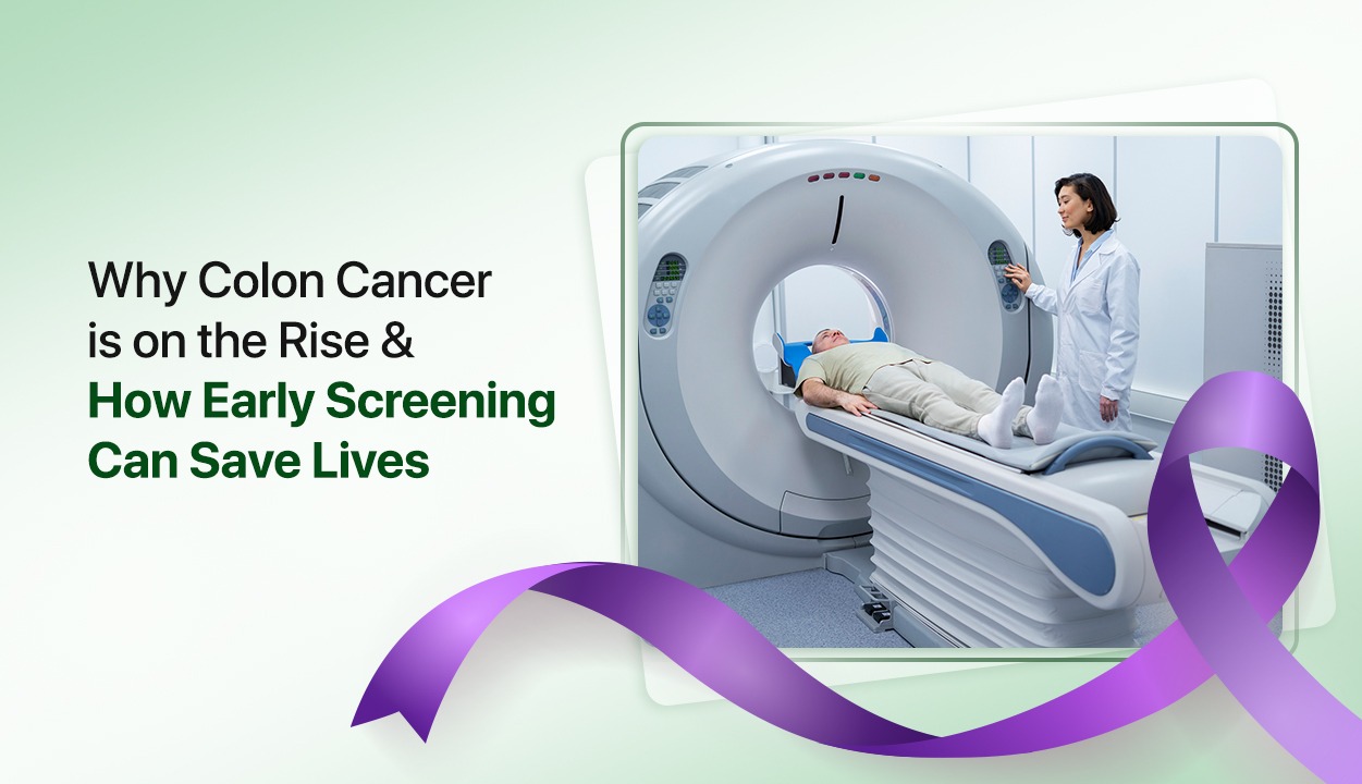 Why Colon Cancer is on the Rise & How Early Screening Can Save Lives