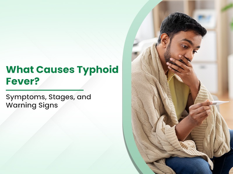 What Causes Typhoid Fever? Symptoms, Stages, and Warning Signs