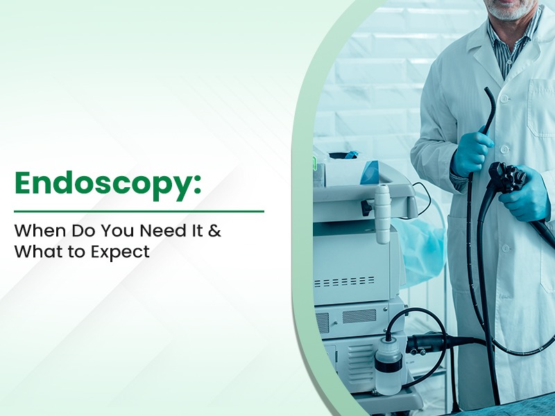 Endoscopy: When Do You Need It & What to Expect
