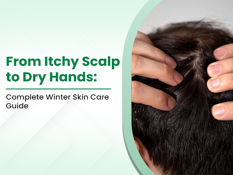 From Itchy Scalp to Dry Hands: Complete Winter Skin Care Guide