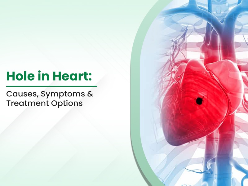 Hole in Heart: Causes, Symptoms & Treatment Options
