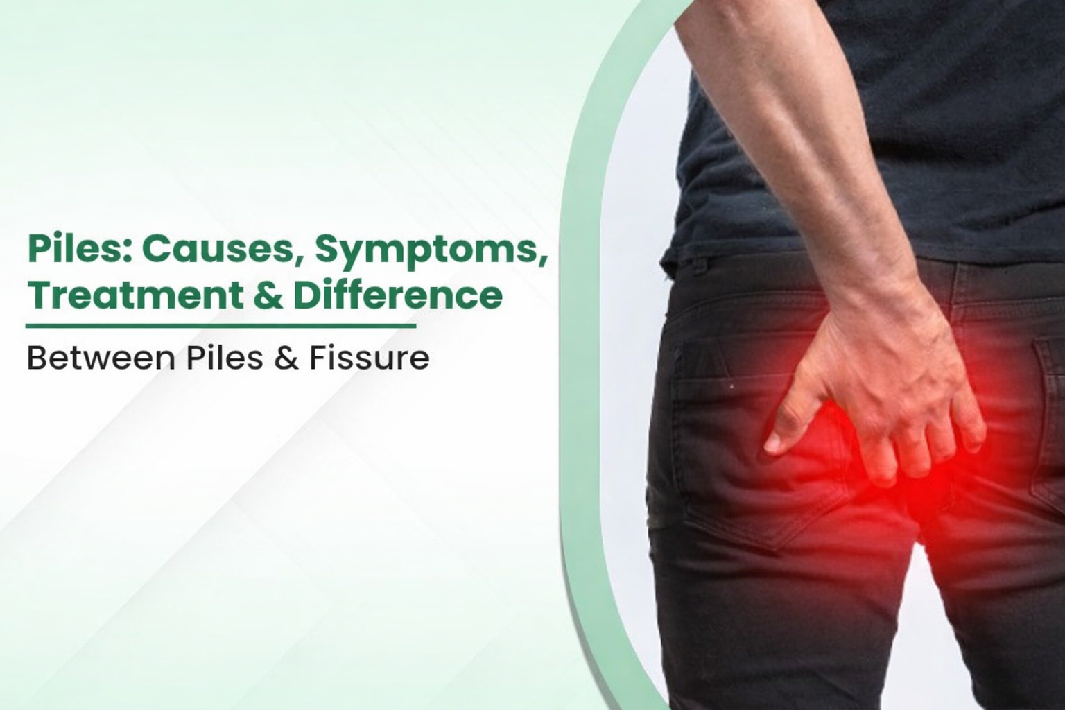 Piles: Causes, Symptoms, Treatment & Difference Between Piles & Fissure