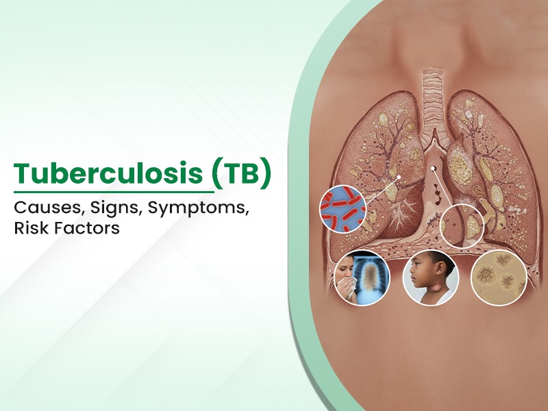 Tuberculosis (TB): Causes, Signs, Symptoms, Risk Factors