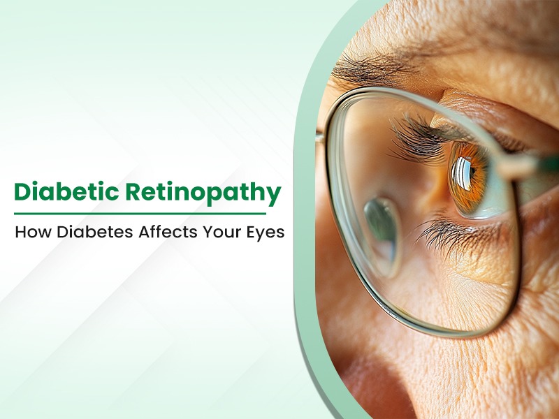 Diabetic Retinopathy: How Diabetes Affects Your Eyes