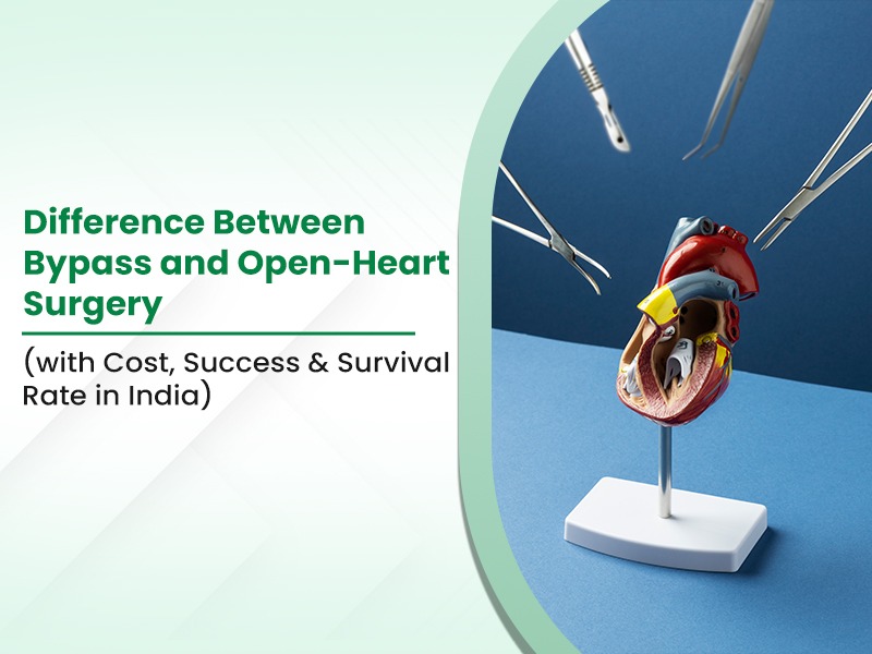 Difference Between Bypass and Open-Heart Surgery (with Cost, Success & Survival Rate in India)