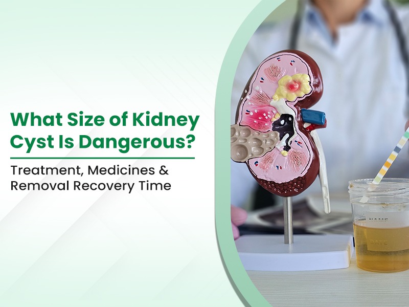 What Size of Kidney Cyst Is Dangerous? Treatment, Medicines & Removal Recovery Time