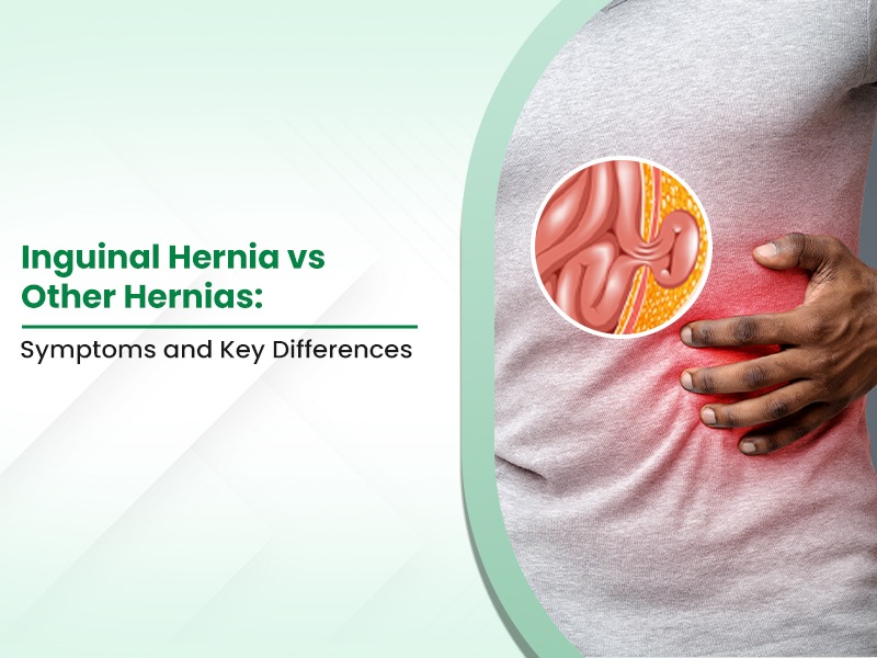 Inguinal Hernia vs Other Hernias Symptoms and Differences