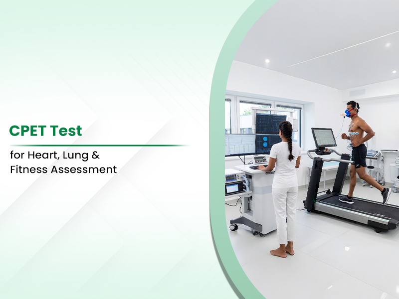CPET Test