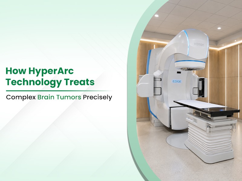 How HyperArc Technology Treats Complex Brain Tumors