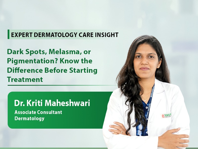 Dark Spots, Melasma, or Pigmentation? 
