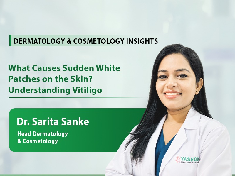 What Causes Sudden White Patches on the Skin