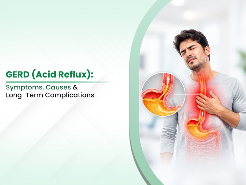 GERD (Acid Reflux): Symptoms, Causes & Long-Term Complications