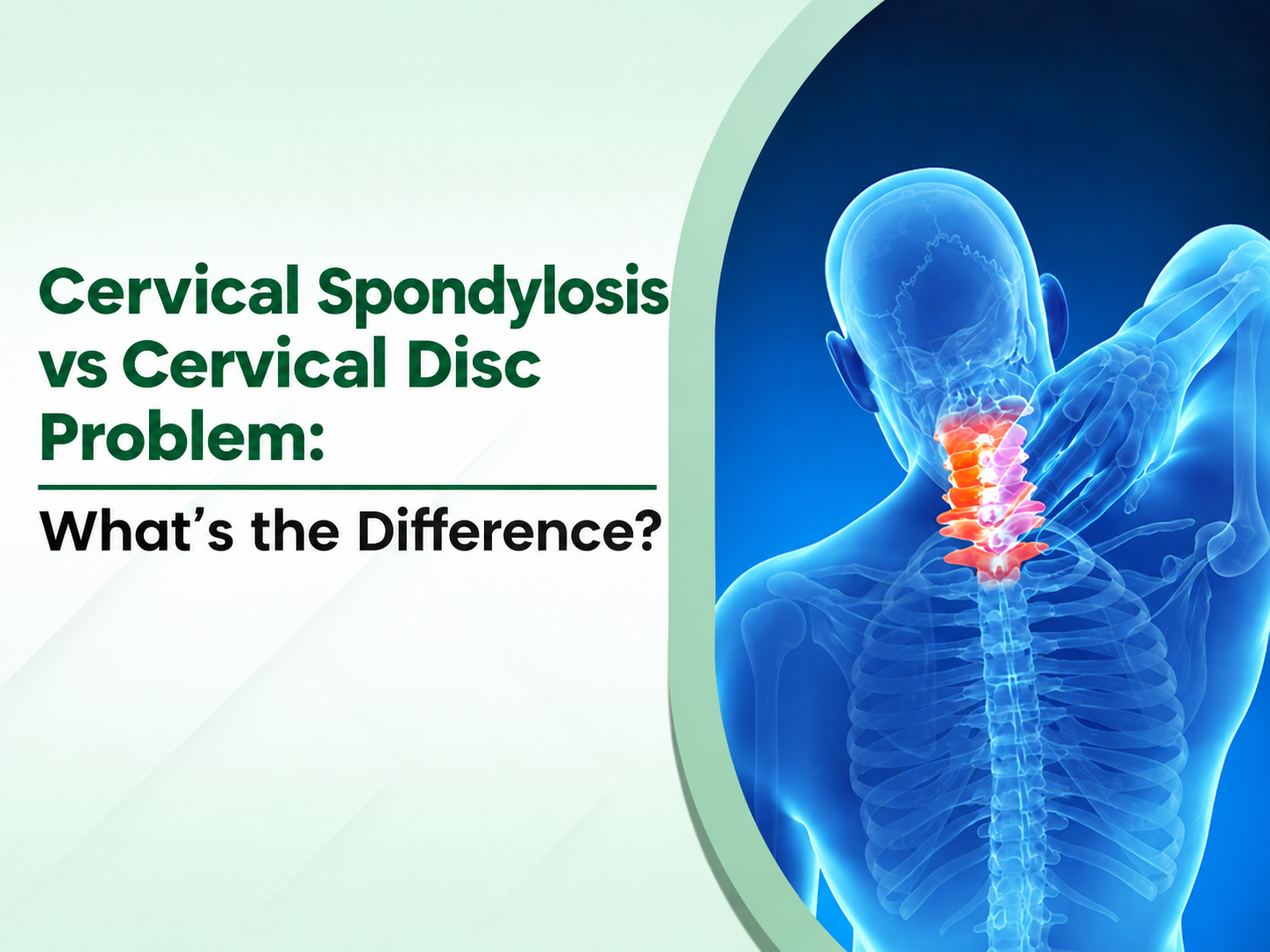 Cervical Spondylosis vs Cervical Disc Problem