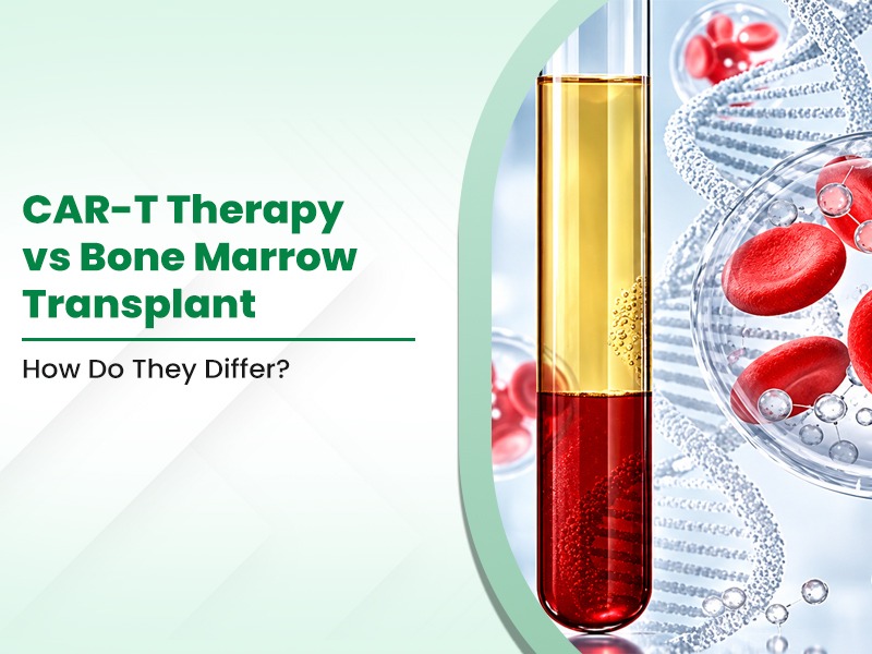 CAR-T Therapy vs Bone Marrow Transplant: How Do They Differ?