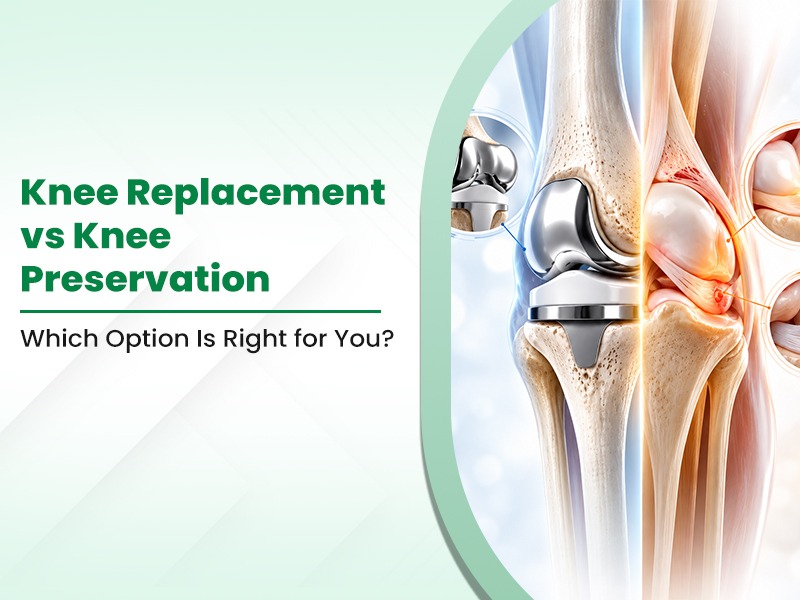 Knee Replacement vs Knee Preservation